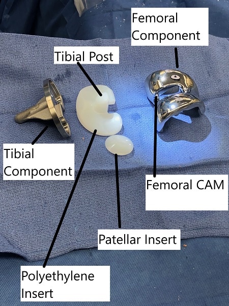 Knee replaceemnt parts