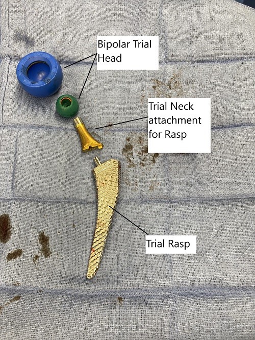 Intraoperative image of total hip replacement. Intraoperative image of total hip replacement.