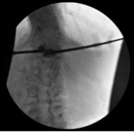 Imágenes fluoroscópicas