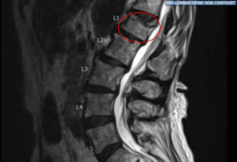 Radiografía preoperatoria