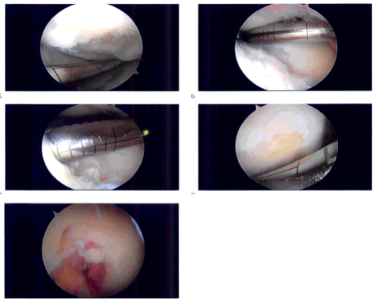 Imágenes intraoperatorias